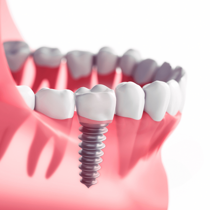 Endodonti